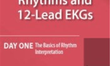 Fundamentals of Rhythms and 12-Lead EKGs: Day One: The Basics of Rhythm Interpretation - Cathy Lockett