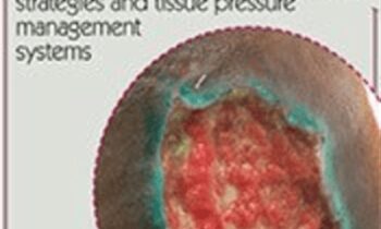 Is it a pressure ulcer or moisture-associated skin damage? Wound identification tips