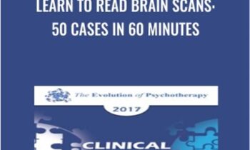 Learn to Read Brain Scans: 50 cases in 60 Minutes - Daniel Amen