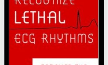 Recognize Lethal ECG Rhythms: Conquer the Patient Clues - Robin Gilbert