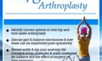 Restoring Balance and Function after Hip and Ankle Arthroplasty - Jason Handschumacher