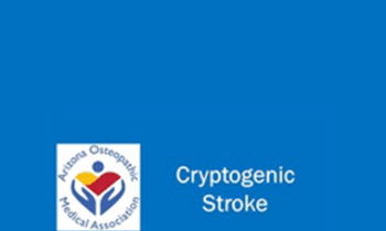 Alphonse Ambrosia - Cryptogenic Stroke