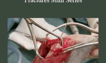 CPD - MS053 – How To Fix Fractures Mini Series