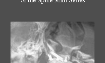 CPD - MS132 – Surgical Conditions of the Spine Mini Series