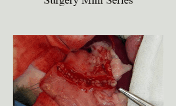 CPD - MS175 Gastrointestinal Surgery Mini Series