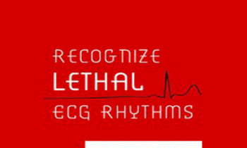 Robin Gilbert - Recognize Lethal ECG Rhythms: Conquer the Patient Clues