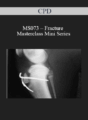 CPD – MS073 – Fracture Masterclass Mini Series