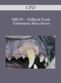 CPD – MS153 – Difficult Tooth Extractions Mini-Series