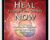 How to Heal Yourself and Others Now – Jimmy Mack