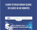 Learn to Read Brain Scans: 50 cases in 60 Minutes – Daniel Amen