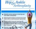 Restoring Balance and Function after Hip and Ankle Arthroplasty – Jason Handschumacher